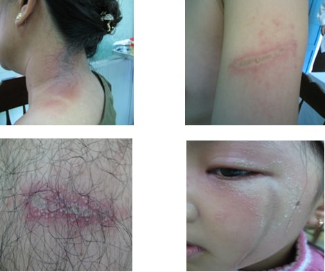 T&aacute;c hại kiến ba khoang g&acirc;y ra