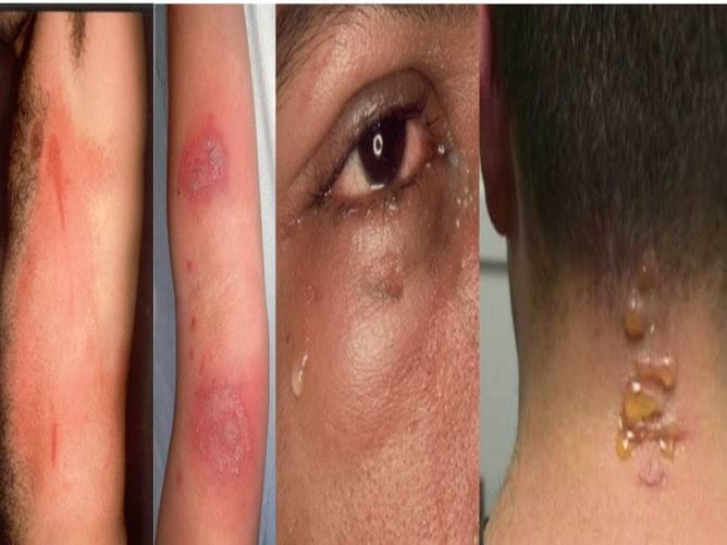 tac-hai-kien-ba-khoang_1